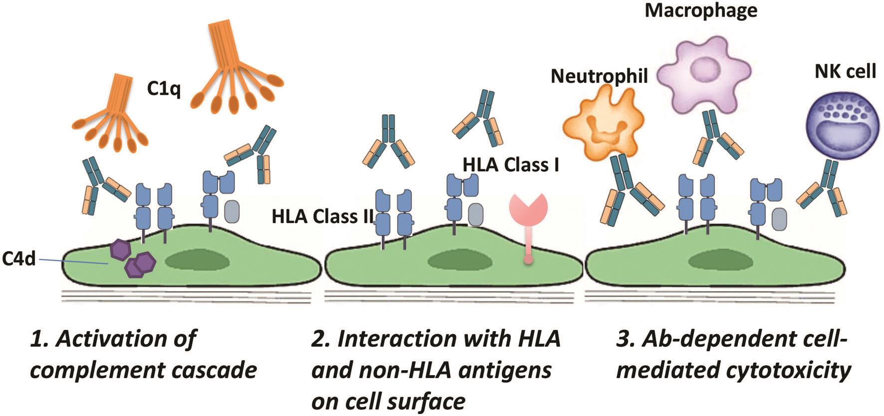 donor-specific-hla-antibodies-in-solid-organ-transplantation-clinical