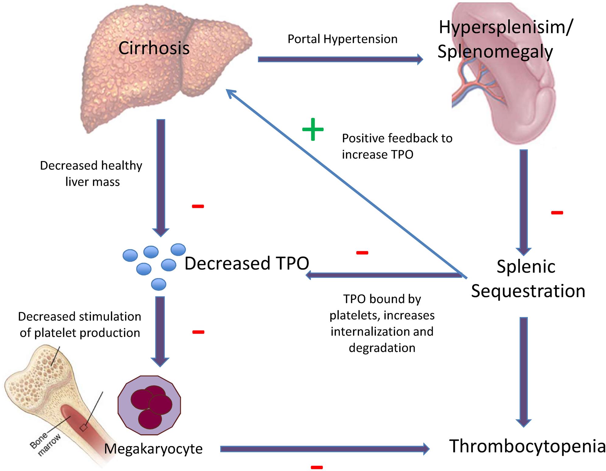 pathogenesis-of-thrombocytopenia-in-chronic-hcv-infection-a-review