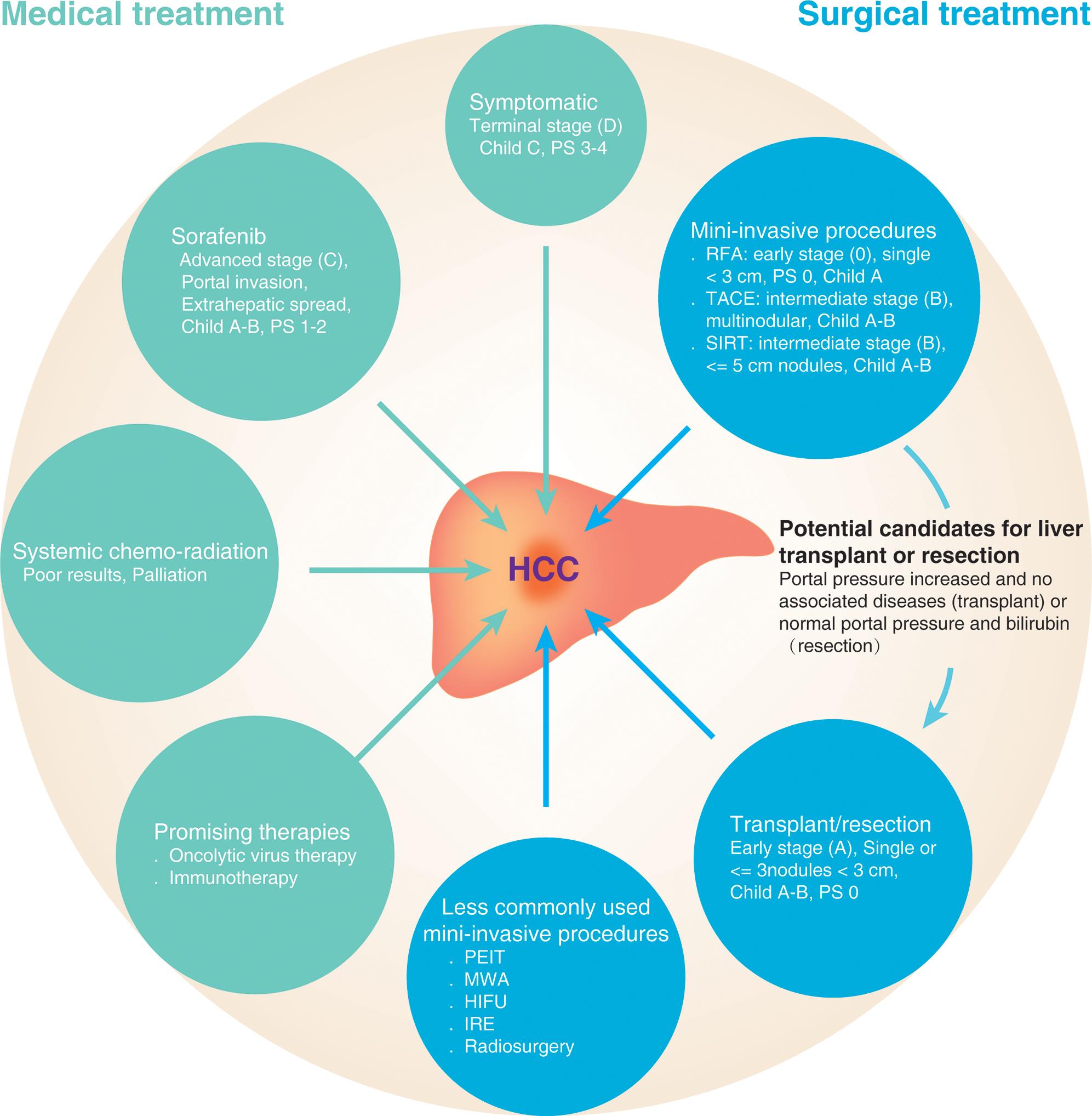 current-and-future-treatment-of-hepatocellular-carcinoma-an-updated